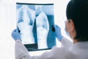 Repair damage lungs after Quitting Smoking